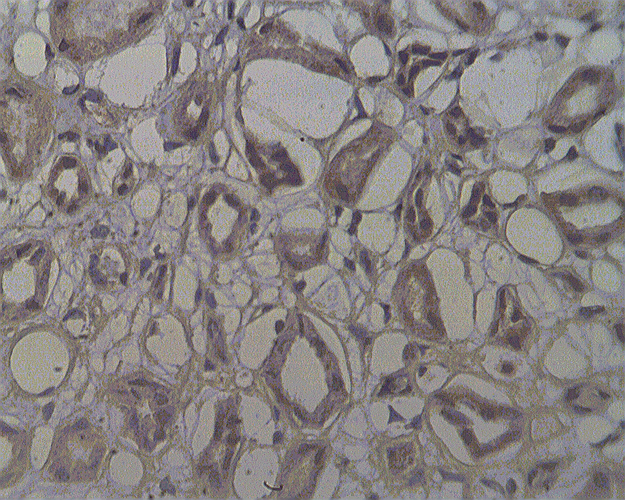 Staining on paraffin embedded normal human kidney sections using NOL4 antibody (Cat. No. X2417P) at 10 µg/ml.  Antigen retrieval used: 10 mM Na Citrate pH 6.0, 10 minutes pressure cooker method, developed with anti rabbit HRP and DAP substrate. Counterstained with methyl blue.